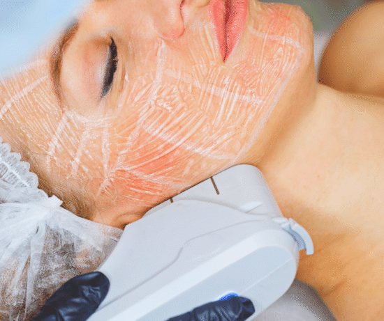 hifu ultrasonidos localizados